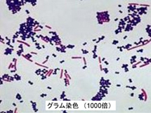 グラム染色000倍