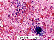 グラム染色00倍