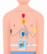 ホルター心電図